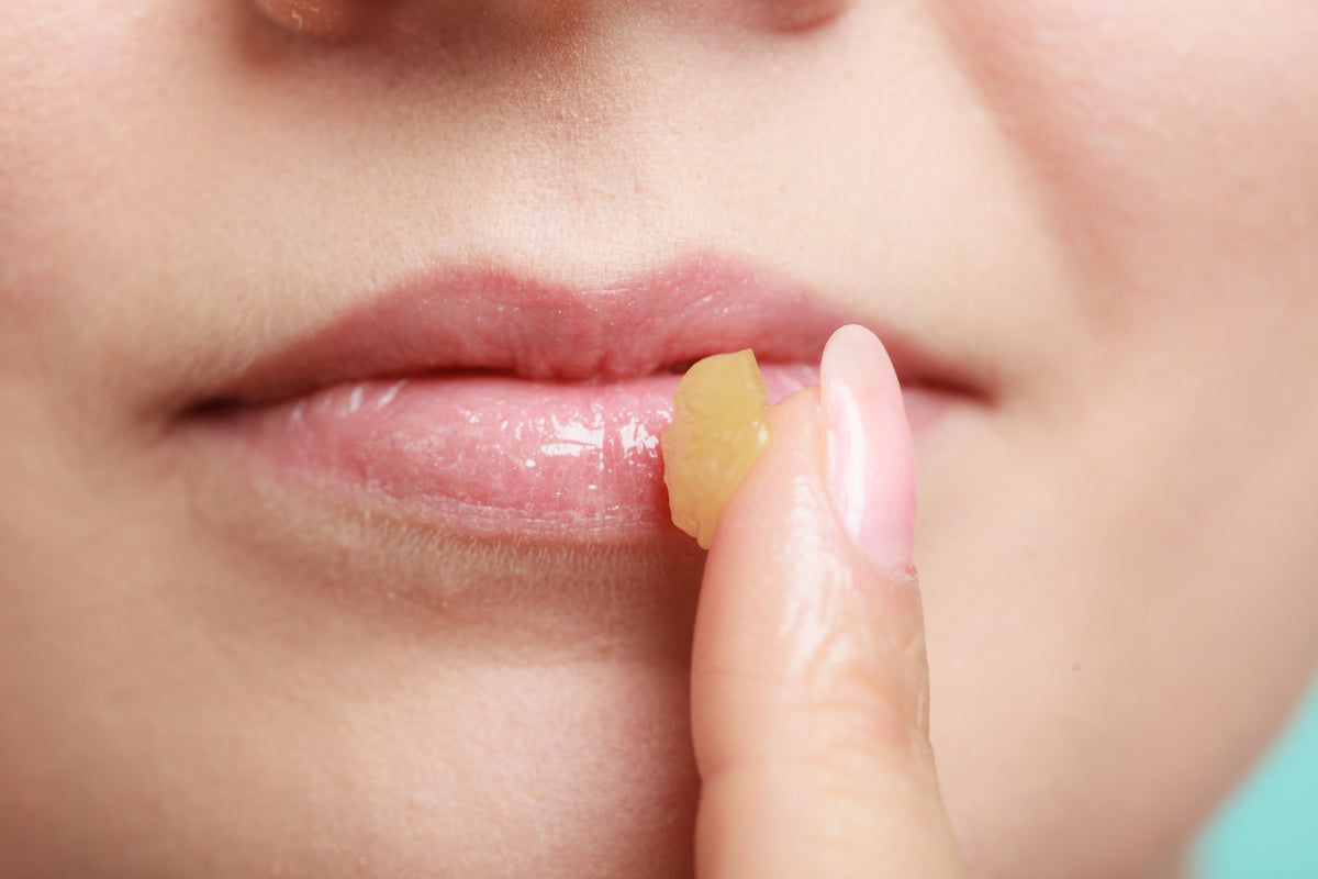 How To Get Rid of Chapped Lips