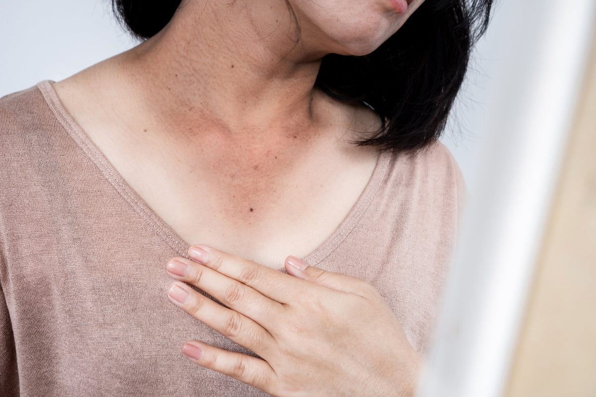 Sun Damage on the Neck & Chest: Crepey Skin and Decolletage Discoloration