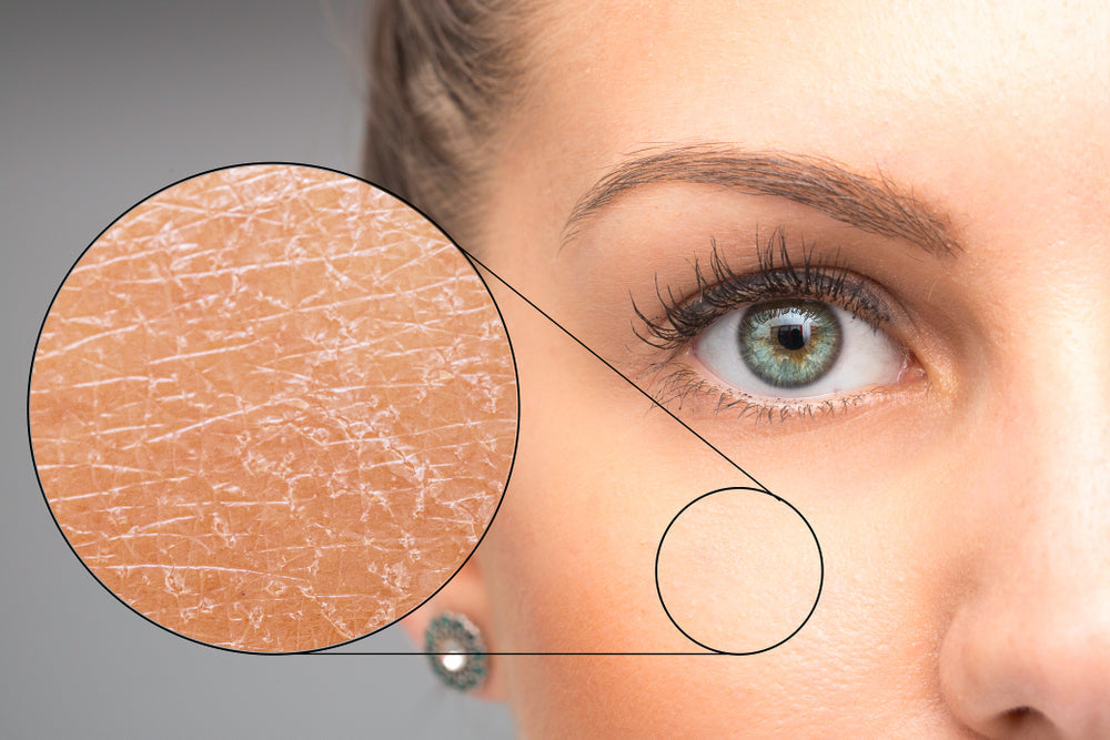 Close up a woman's eye and cheek with a magnified area of skin that shows dryness.