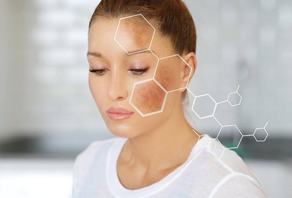 Woman's face with a damaged skin barrier