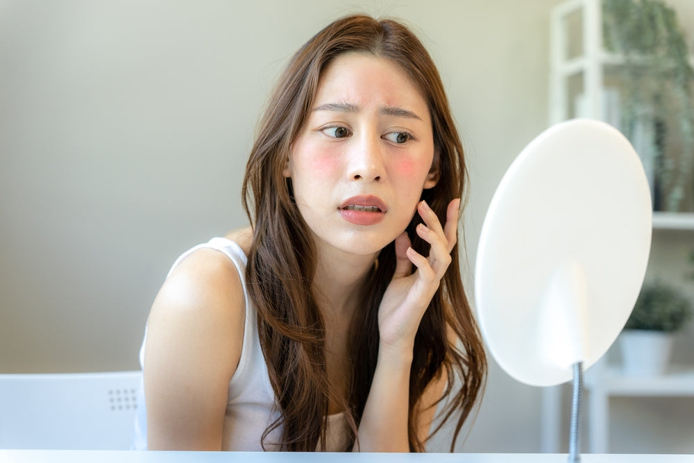 Young woman with sunburned cheeks looking at herself in a mirror.