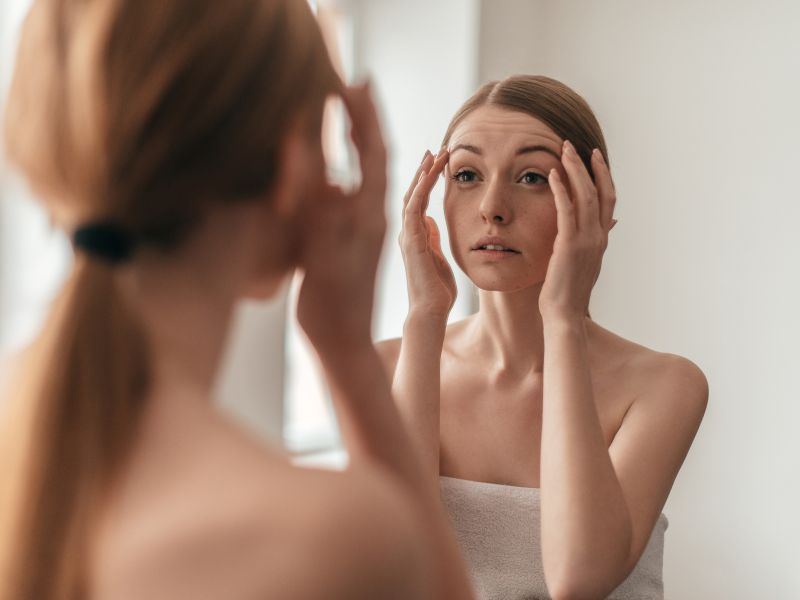 Melasma Causes, Treatment & Prevention