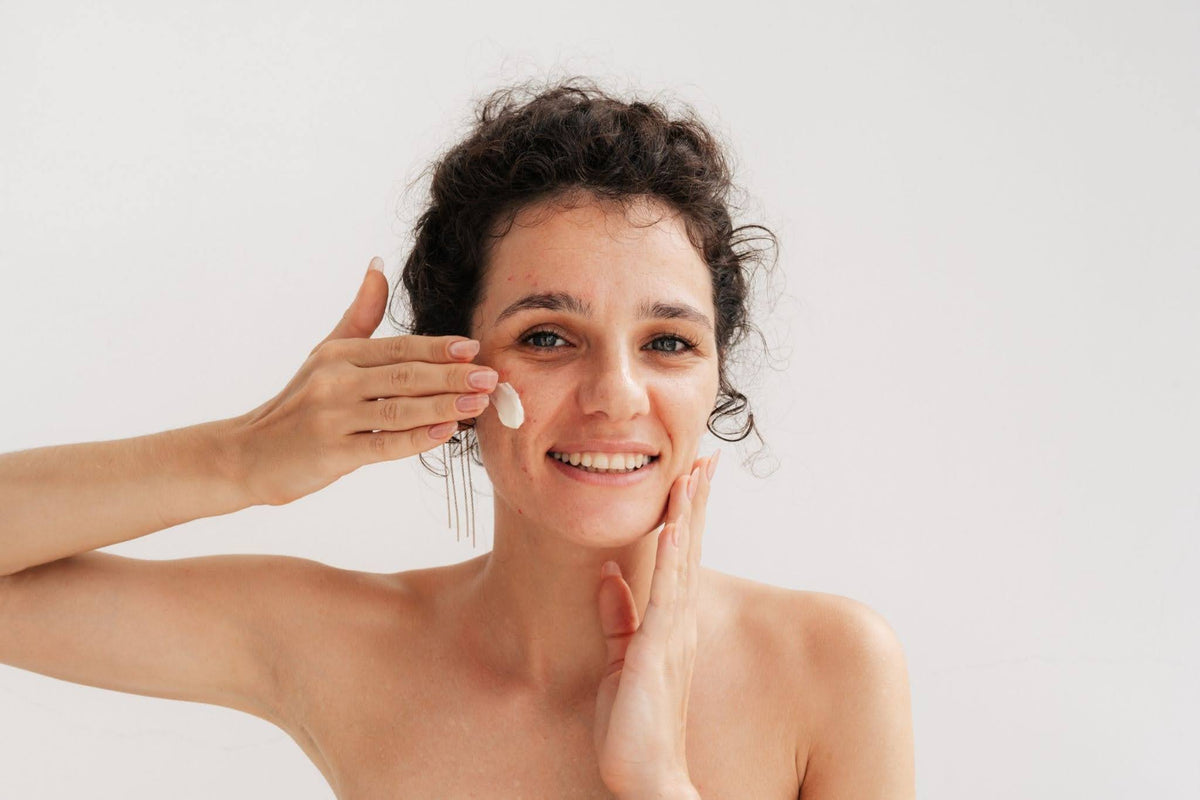 Best Sunscreen for Acne-Prone Skin: How to Stay Protected Without Breaking Out