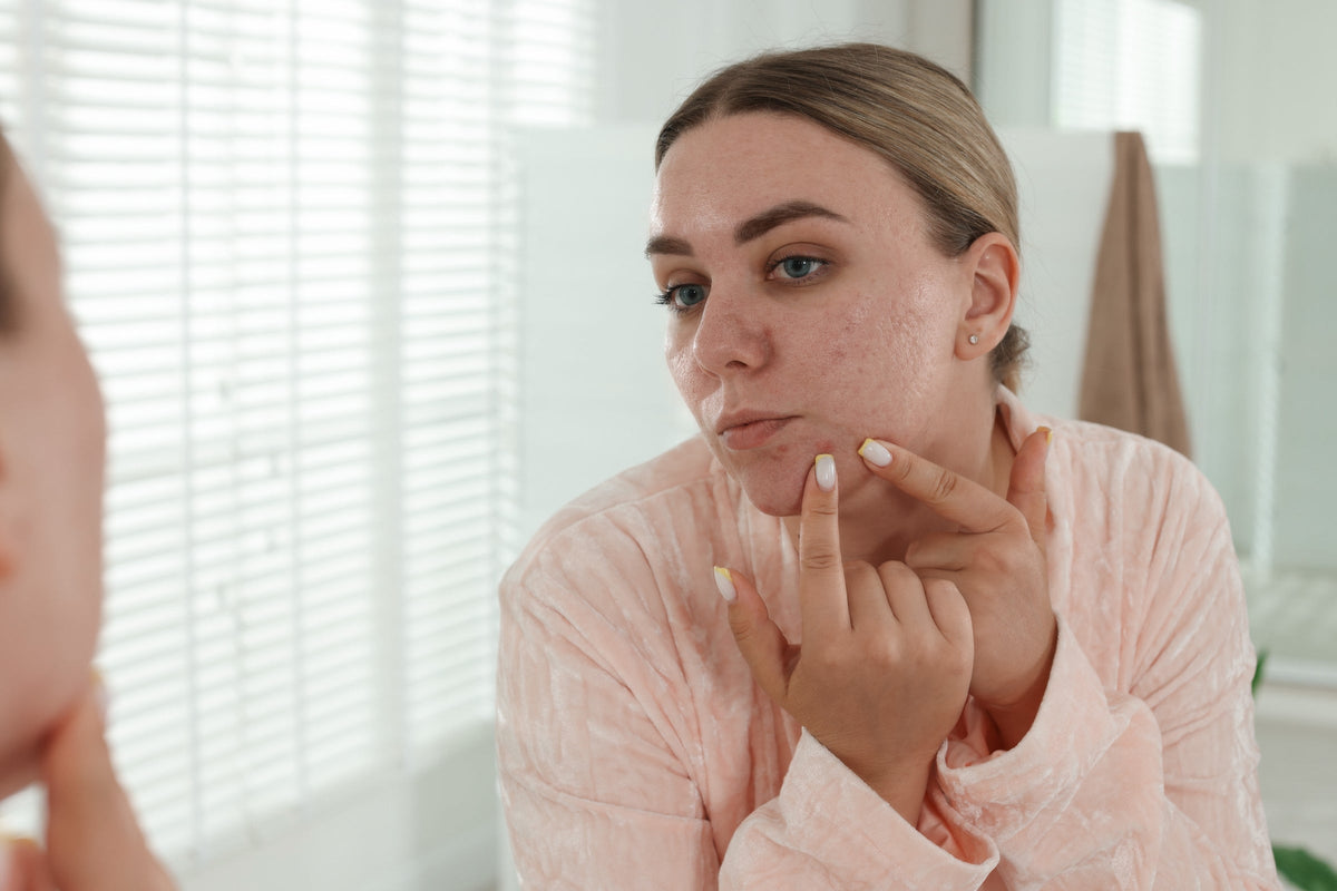 Does Niacinamide Cause Acne? The Truth About This Ingredient
