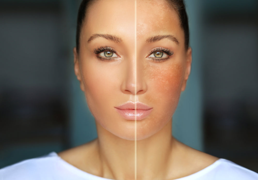 how many shades can glutathione lighten Fix, Treat & Reduce Uneven Skin Tone on Face Understanding How Common Medications for-active-adults SIZE::120 ml / 4 oz