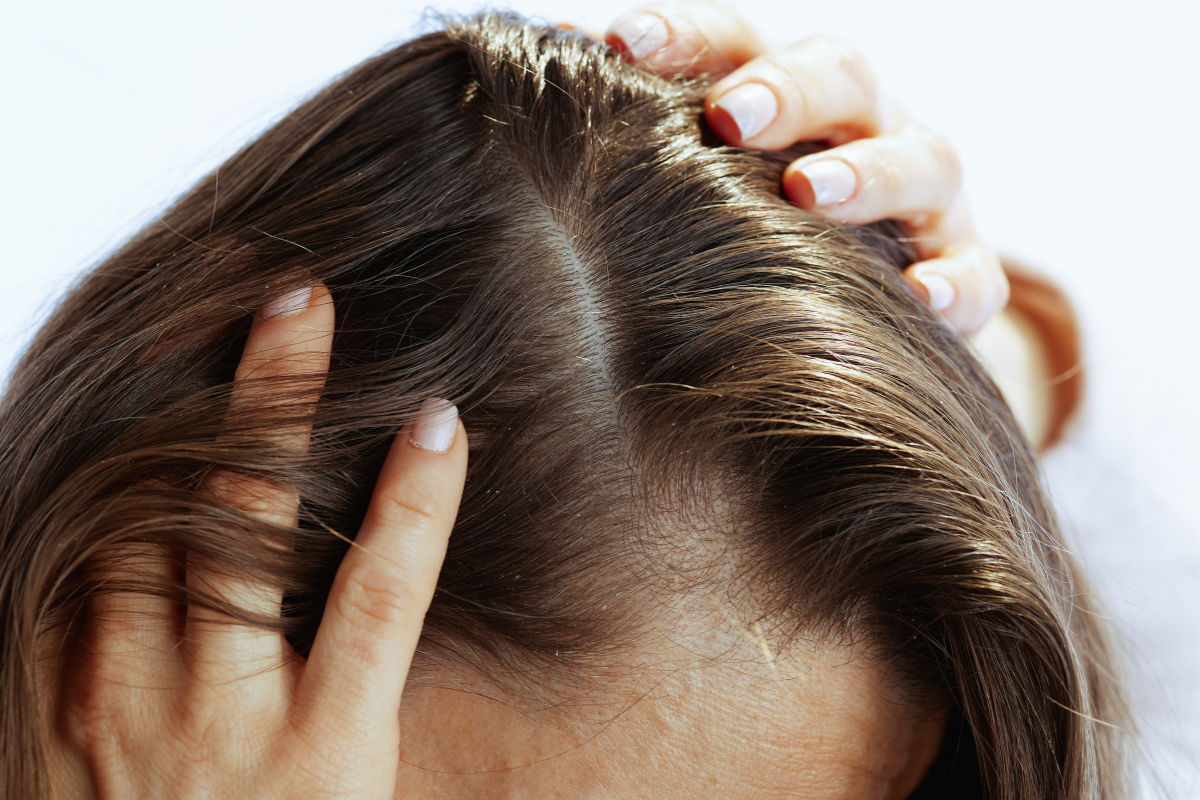How to Protect Your Scalp & Hair Part From the Sun