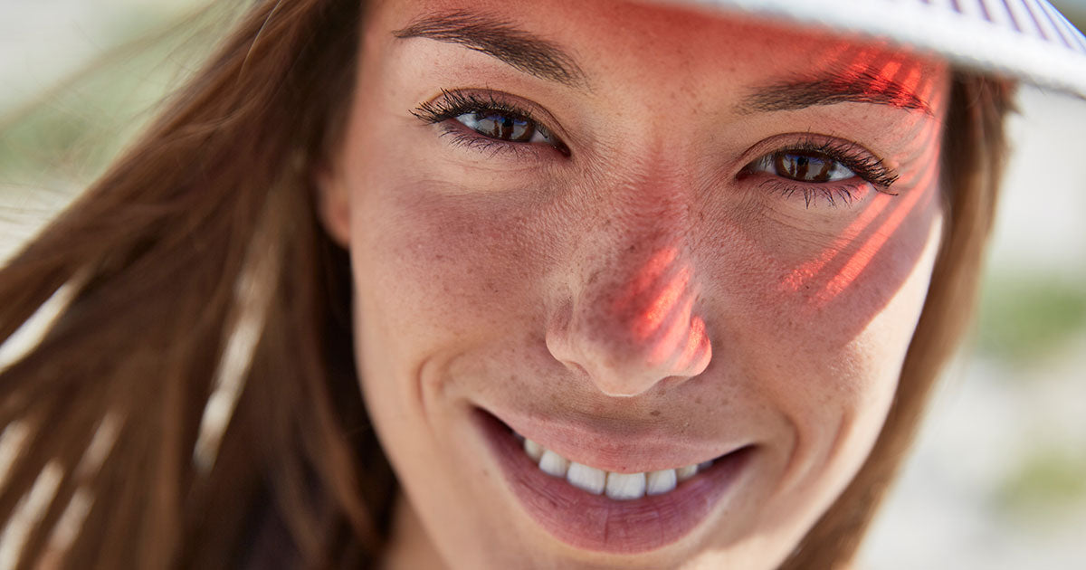 Hyperpigmentation: What Is It and How Do I Treat It?