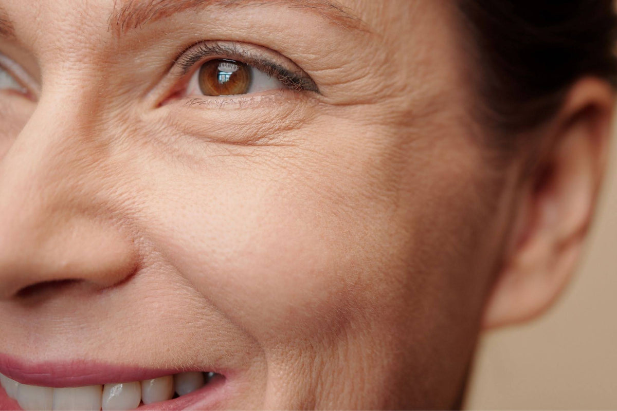 What Causes Skin to Sag Around the Eyes, and How to Firm It Up