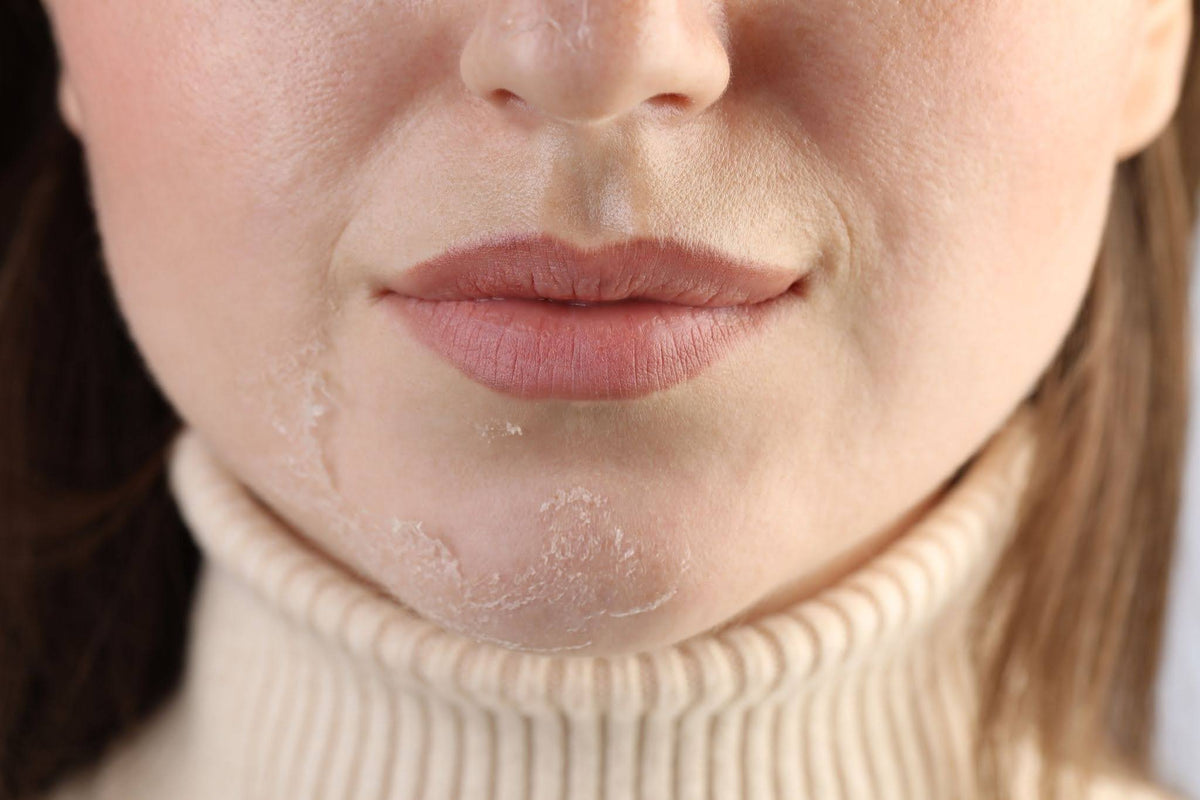 What Is Transepidermal Water Loss (TEWL) and Why It's Secretly Drying Out Your Skin