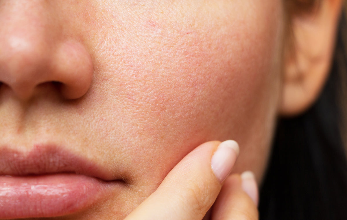 How to Shrink Pores: Tips for Reducing Pores on Your Face