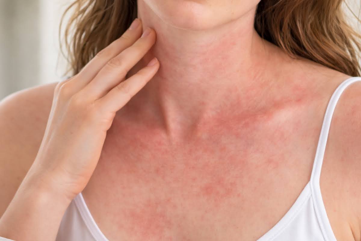 Why Does Sunscreen Burn My Face? Gentle Mineral SPF Tips