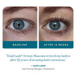 Total Lash® Serum Mascara clinical study before and after