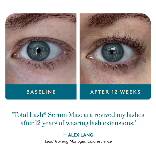 Total Lash® Serum Mascara clinical study before and after