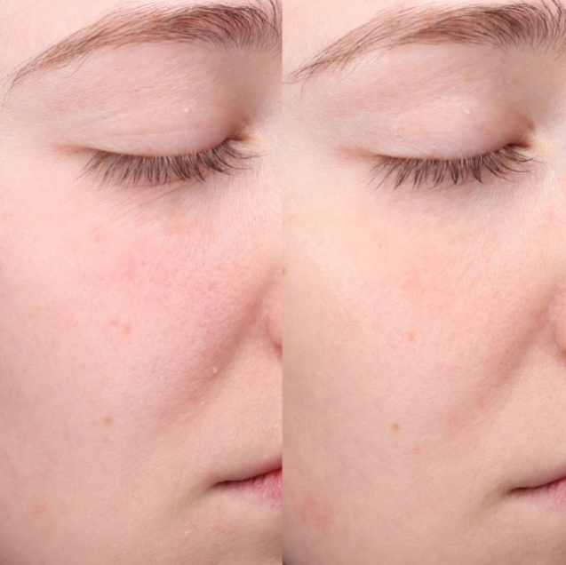 Colorescience