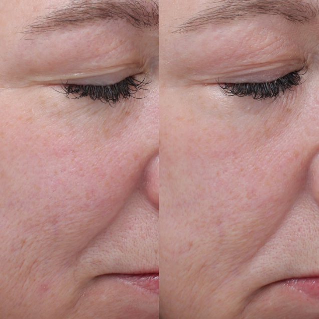 Colorescience
