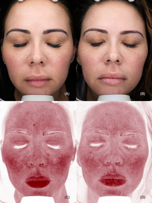 Colorescience