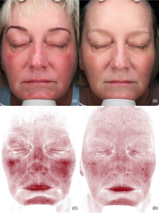 Colorescience