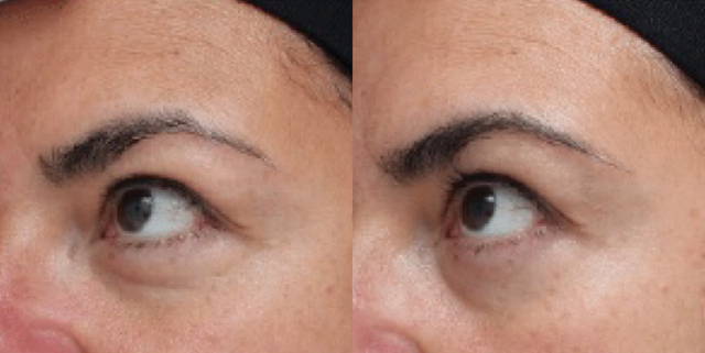 Colorescience