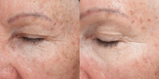 Colorescience