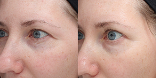 Colorescience