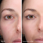 Total Eye 3-in-1 Renewal Therapy SPF 35 Before & After results