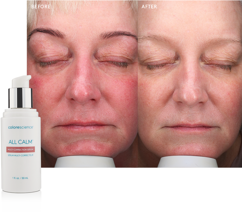 Colorescience