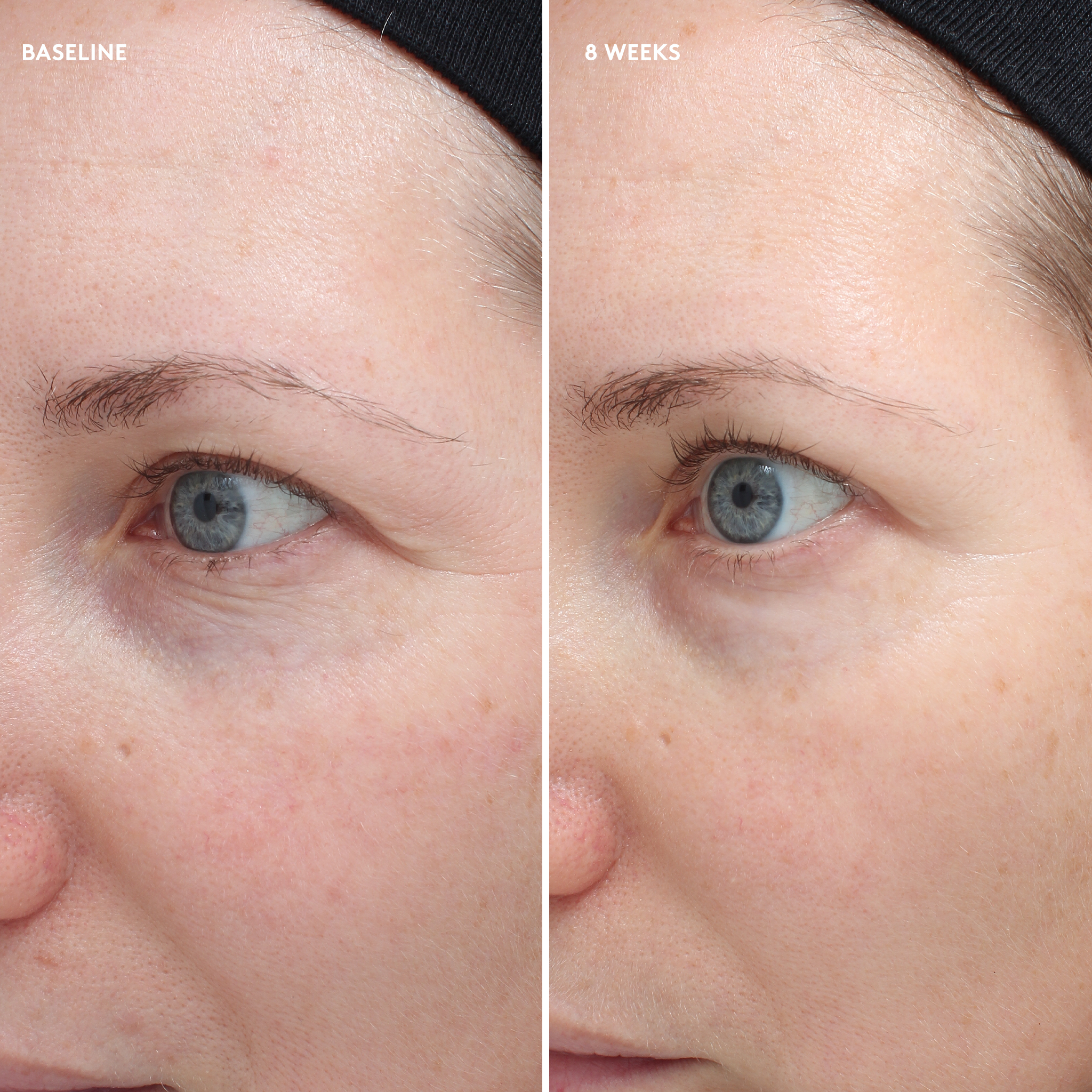 Clean Skin Club Stem Cell+ Brightening Eye Cream